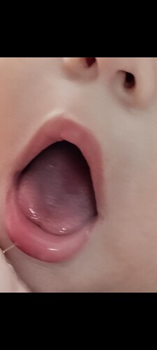 Screenshot_2025-08-03-12-57-16-543_com.whatsapp